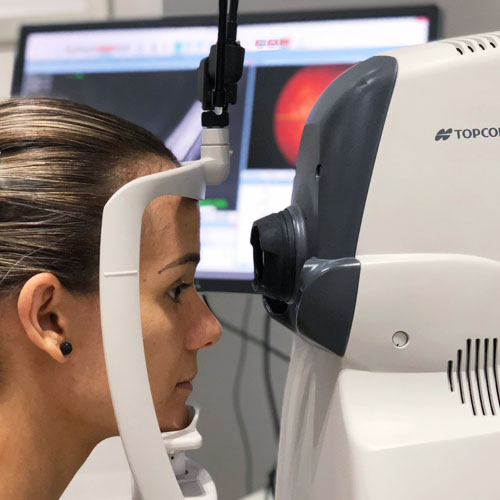 Angiotomografia de glaucoma e retina