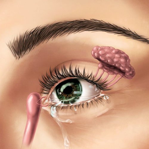 Cirurgia das Vias Lacrimais 